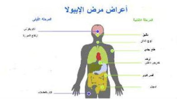 إدخال ثلاثة أشخاص إلی المستشفی في إسبانيا يشتبه بإصابتهم بفيروس إيبولا