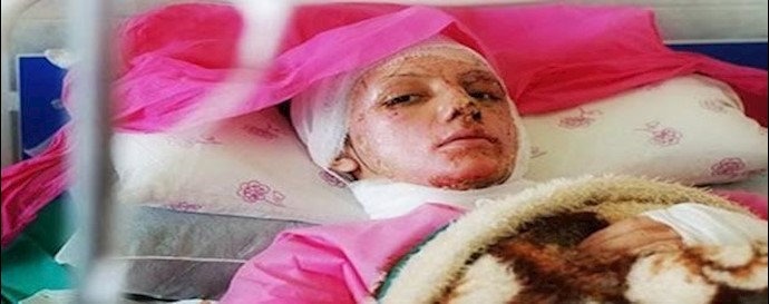 نظام الملالي يقوم بعملية رش الأسيد وما هي مسؤوليتنا تجاه الموقف