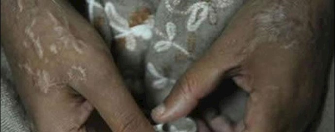 ايران.. تنفيذ حکم إعماء المتهمين بالحامض