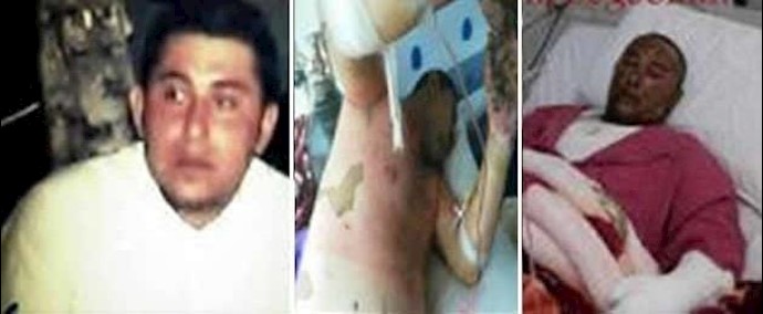 إيران.. مصرع مؤلم لشاب من أهالي خوزستان إثر حرق نفسه احتجاجا علی نظام الملالي