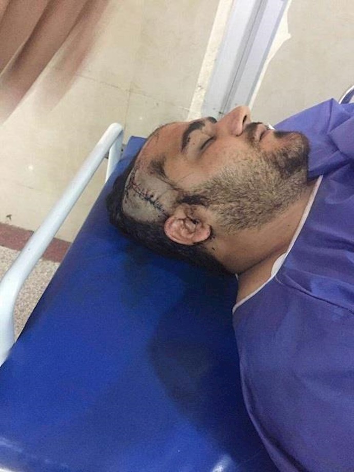 إيران..الاعتداء علی طالب من مدينة الأهواز بالضرب المبرح