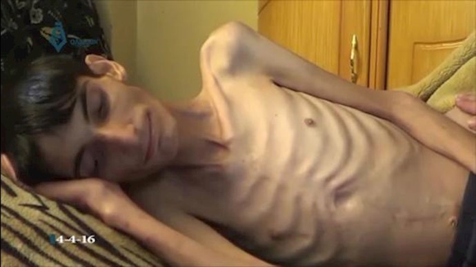 أزمة إنسانية وشيکة في حلب وحالات وفاة جوعا بمضايا