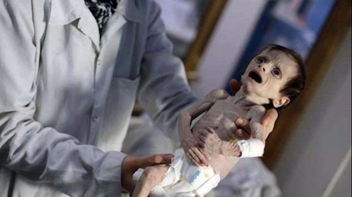 الأمم المتحدة: 400 ألف محاصر في الغوطة الشرقية يواجهون "کارثة کاملة"