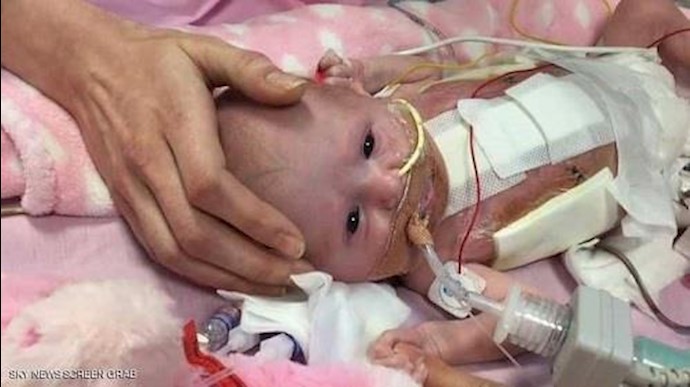 إنقاذ "إعجازي" لرضيعة قلبها خارج جسدها+فيديو