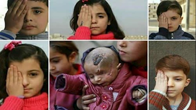 الطفل کريم تحوّل إلی رمز للمطالبة بفک الحصار عن غوطة دمشق