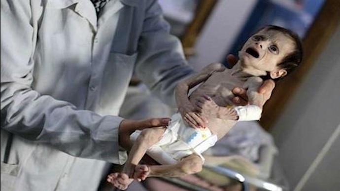 غضب کندي إزاء رفض النظام السوري إخراج محاصرين من الغوطة